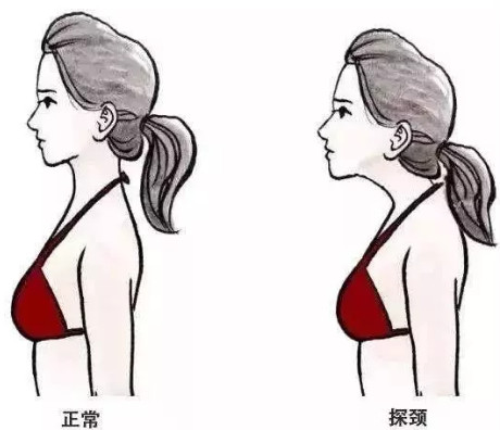 5个少儿常见不良体态，最后一个可能会毁了孩子一生……