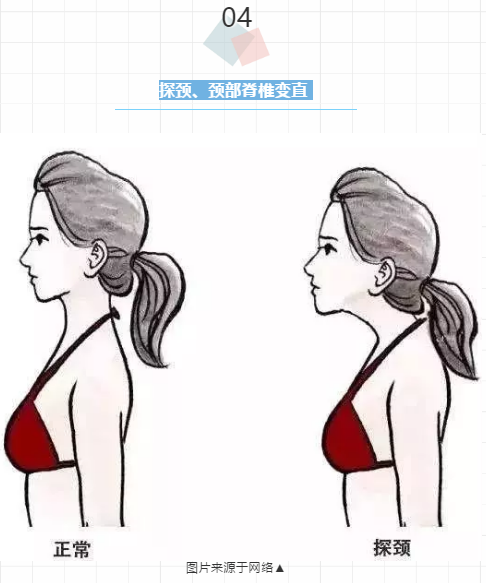 5个少儿常见不良体态，最后一个可能会毁了孩子一生......