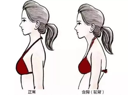 5个少儿常见不良体态，最后一个可能会毁了孩子一生……