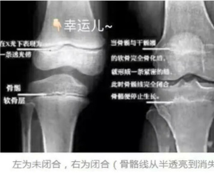 担心孩子身高达不到舞蹈专业要求的家长，弄清楚这些了吗？